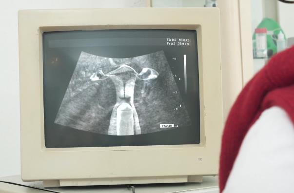 医院B超仪，带老婆看到的东西，CC神秘地带检查，1V978M